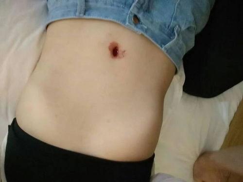 捅肚脐视频,惊险瞬间背后的真相与警示